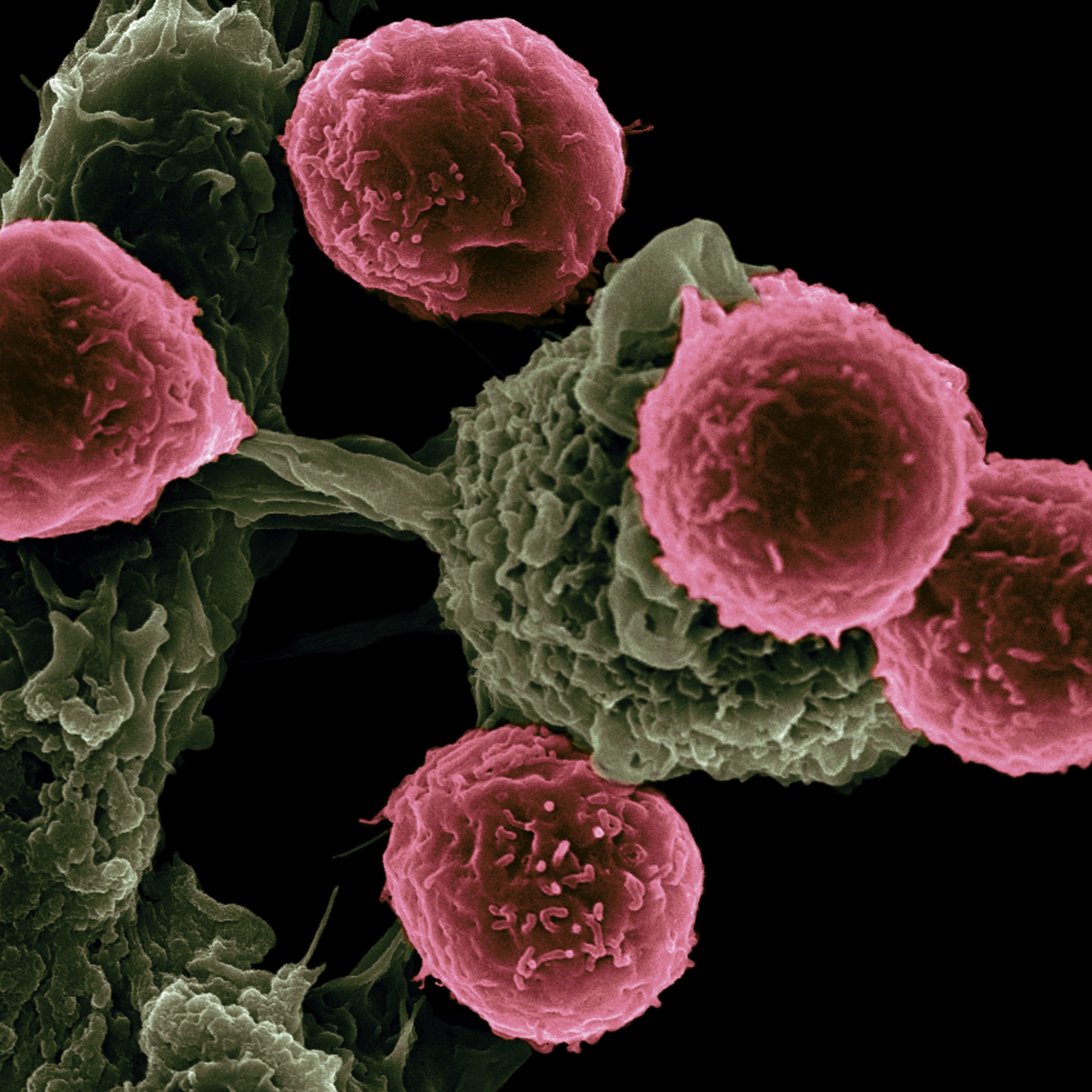 SEM of CAR T cells