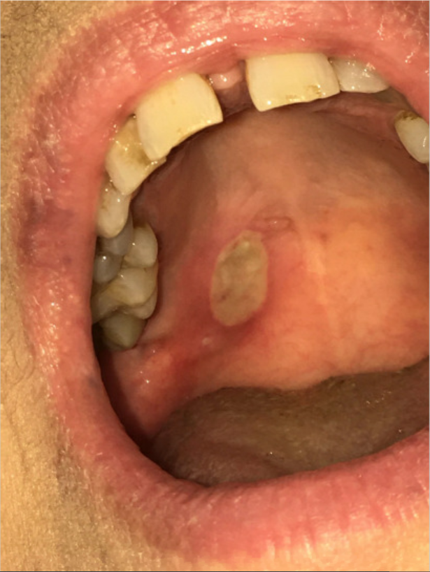 Figure 1: Clinical photograph at initial presentation.