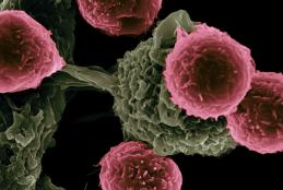 SEM of CAR T cells